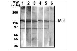 Western Blotting (WB) image for anti-Met Proto-Oncogene (MET) (pTyr1234), (pTyr1235) antibody (ABIN356338) (c-MET antibody  (pTyr1234, pTyr1235))