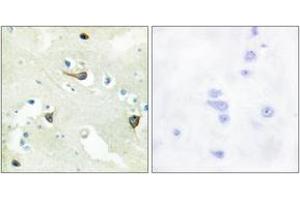Immunohistochemistry analysis of paraffin-embedded human brain tissue, using EPHB1/2/3 Antibody. (EPH Receptor B1/2/3 (AA 631-680) antibody)