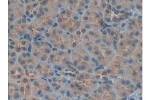 Detection of IGFBP5 in Mouse Kidney Tissue using Polyclonal Antibody to Insulin Like Growth Factor Binding Protein 5 (IGFBP5) (IGFBP5 antibody  (AA 25-271))