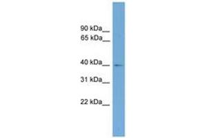 Image no. 1 for anti-CAMP Responsive Element Binding Protein 5 (CREB5) (AA 151-200) antibody (ABIN6744632) (CREB5 antibody  (AA 151-200))