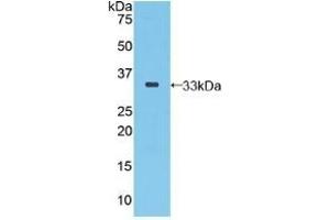 Detection of Recombinant SEPP1, Human using Polyclonal Antibody to Selenoprotein P1, Plasma (SEPP1) (SEPP1 antibody  (AA 60-274))