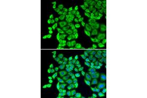 Immunofluorescence (IF) image for anti-Eukaryotic Translation Elongation Factor 1 delta (Guanine Nucleotide Exchange Protein) (EEF1D) antibody (ABIN1872432)