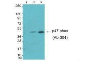 Western blot analysis of extracts from HepG2 cells (Lane 2) and Jurket cells (Lane 3), using Neutrophil Cytosol Factor 1 (Ab-304) antiobdy. (NCF1 antibody  (Ser304))
