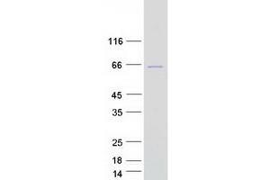 Western Blotting (WB) image for Male-Specific Lethal 3 Homolog (MSL3) (Transcript Variant 1) protein (Myc-DYKDDDDK Tag) (ABIN2726440)