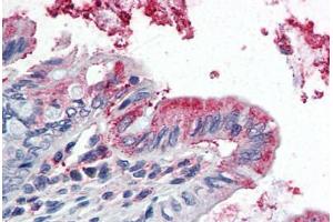 Human Colon (formalin-fixed, paraffin-embedded) stained with GPX3 antibody ABIN364427 at 5 ug/ml followed by biotinylated anti-goat IgG secondary antibody ABIN481715, alkaline phosphatase-streptavidin and chromogen.