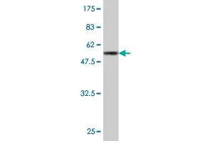 Western Blot detection against Immunogen (55. (GCLM antibody  (AA 1-274))
