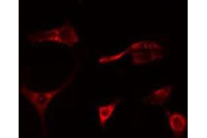 ABIN6278655 staining Hela cells by IF/ICC. (MAP3K1 antibody  (pThr1402))