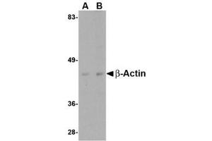 Image no. 1 for anti-Actin, beta (ACTB) (C-Term) antibody (ABIN341734) (beta Actin antibody  (C-Term))
