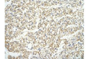 Rabbit Anti-LSM4 antibody   Paraffin Embedded Tissue: Human Heart cell Cellular Data: cardiac cell of renal tubule Antibody Concentration: 4. (LSM4 antibody  (Middle Region))