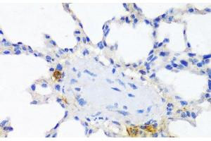 Immunohistochemistry of paraffin-embedded Rat lung using ITGAX Polyclonal Antibody at dilution of 1:100 (40x lens).