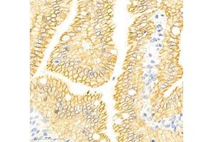 Immunohistochemistry (Paraffin-embedded Sections) (IHC (p)) image for anti-Annexin A4 (ANXA4) antibody (ABIN7073066)