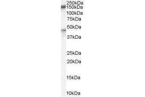 ABIN185667 (1µg/ml) staining of Human Brain lysate (35µg protein in RIPA buffer). (Patched 1 antibody  (Internal Region))