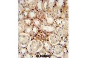 Immunohistochemistry (IHC) image for anti-ATP Synthase, H+ Transporting, Mitochondrial Fo Complex, Subunit J2 (ATP5J2) antibody (ABIN3002313) (ATP5J2 antibody)