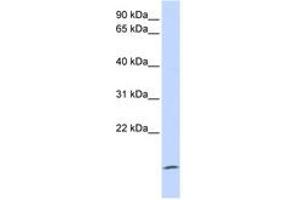 Image no. 1 for anti-Zymogen Granule Protein 16 (ZG16) (AA 72-121) antibody (ABIN6743681) (ZG16 antibody  (AA 72-121))