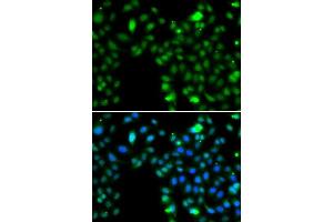 Immunofluorescence analysis of MCF-7 cells using ING5 antibody. (ING5 antibody  (AA 1-220))