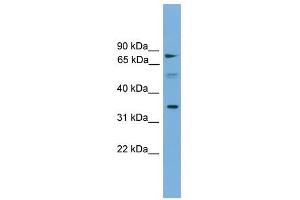 OSTalpha antibody used at 1 ug/ml to detect target protein. (OST alpha antibody  (Middle Region))