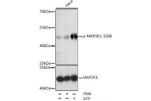 Western blot analysis of extracts of various cell lines using Phospho-MAP2K1(S298) Polyclonal Antibody at dilution of 1:1000. (MEK1 antibody  (pSer298))