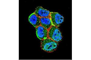 Confocal immunofluorescent analysis of STK11 (LKB1) Antibody (N-term I29) (ABIN391350 and ABIN2841371) with ZR-75-1 cell followed by Alexa Fluor 488-conjugated goat anti-rabbit lgG (green). (LKB1 antibody  (N-Term))