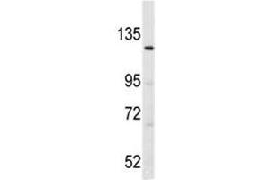 Western blot analysis of LATS1 antibody and K562 lysate. (LATS1 antibody  (AA 1-30))