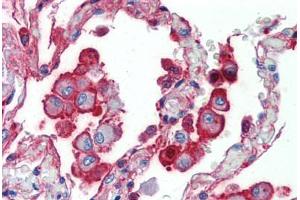 Human Lung (formalin-fixed, paraffin-embedded) stained with ALPL antibody ABIN462352 followed by biotinylated anti-mouse IgG secondary antibody ABIN481714, alkaline phosphatase-streptavidin and chromogen. (ALPL antibody)