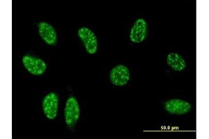 Immunofluorescence of monoclonal antibody to TSC22D3 on HeLa cell.