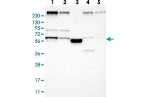 Western blot analysis of Lane 1: RT-4, Lane 2: U-251 MG, Lane 3: Human Plasma, Lane 4: Liver, Lane 5: Tonsil with FAM134C polyclonal antibody  at 1:250-1:500 dilution. (FAM134C antibody)