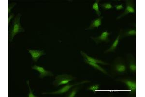 Immunofluorescence (IF) image for anti-Protein Phosphatase 2A Activator, Regulatory Subunit 4 (PPP2R4) (AA 1-323) antibody (ABIN519124)