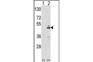 Western blot analysis of PKM2 (arrow) using rabbit polyclonal PKM2 Antibody (N-term ) (ABIN653018 and ABIN2842641). (PKM2 antibody  (N-Term))