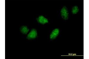 Immunofluorescence of purified MaxPab antibody to DDX3Y on HeLa cell. (DDX3Y antibody  (AA 1-660))