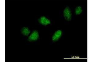 Immunofluorescence of purified MaxPab antibody to DDX3Y on HeLa cell.