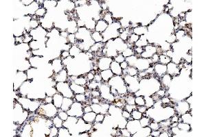 IHC analysis of Galectin 3/LGALS3 using anti-Galectin 3/LGALS3 antibody (ABIN3043400). (Galectin 3 antibody  (AA 153-264))