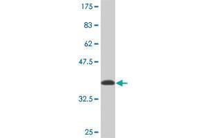 Western Blot detection against Immunogen (36. (NARF antibody  (AA 1-100))