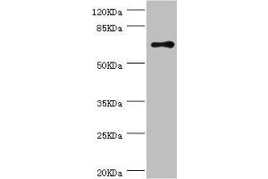 Western blot All lanes: RNGTT antibody at 1.