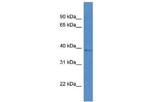 Western Blot showing AKR1D1 antibody used at a concentration of 1 ug/ml against RPMI-8226 Cell Lysate
