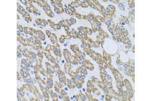 Immunohistochemistry of paraffin-embedded Human liver damage using NTF4 Polyclonal Antibody at dilution of 1:100 (40x lens). (Neurotrophin 4 antibody)