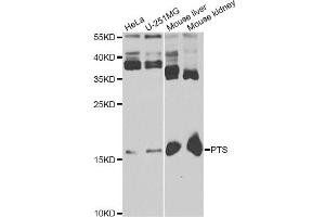Western blot analysis of extracts of various cell lines, using PTS antibody (ABIN5973727) at 1/1000 dilution. (PTS antibody)
