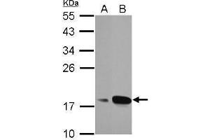 WB Image Sample (30 ug of whole cell lysate) A: A549 B: MCF-7 12% SDS PAGE antibody diluted at 1:1000 (AGR3 antibody  (Center))