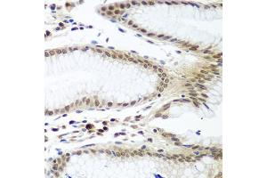 Immunohistochemistry of paraffin-embedded human stomach using PTTG1 antibody (ABIN5974823) at dilution of 1/100 (40x lens). (PTTG1 antibody)