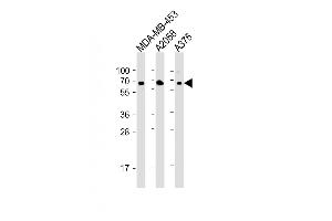 All lanes : Anti-CD63 Antibody (C-term) at 1:2000 dilution Lane 1: MDA-MB-453 whole cell lysate Lane 2:  whole cell lysate Lane 3:  whole cell lysate Lysates/proteins at 20 μg per lane. (CD63 antibody  (C-Term))