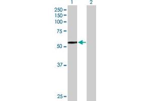 Western Blot analysis of HEXA expression in transfected 293T cell line by HEXA MaxPab polyclonal antibody.
