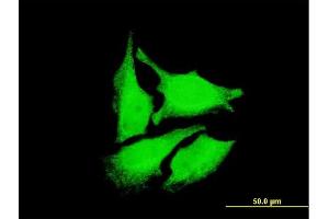 Immunofluorescence of monoclonal antibody to DEPDC1 on HeLa cell. (DEPDC1 antibody  (AA 93-186))