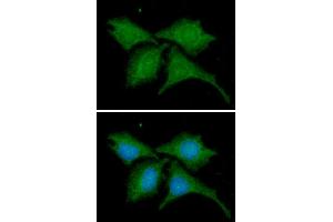 ICC/IF analysis of B2M in HeLa cells line, stained with DAPI (Blue) for nucleus staining and monoclonal anti-human B2M antibody (1:100) with goat anti-mouse IgG-Alexa fluor 488 conjugate (Green). (beta-2 Microglobulin antibody  (AA 21-119))