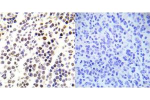 Immunohistochemical analysis of paraffin-embedded human malignant lymphoma tissue using Histone H3.