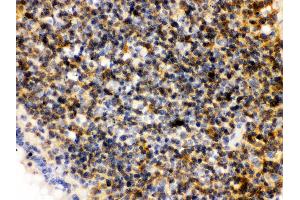 Anti- PLK1 Picoband antibody,IHC(P) IHC(P): Rat Lymphaden Tissue (PLK1 antibody  (AA 86-430))