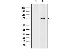 anti-Osteoactivin (GPNMB) (Internal Region) antibody