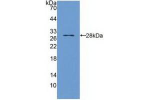 Western blot analysis of recombinant Human TIRAP. (TIRAP antibody  (AA 1-221))