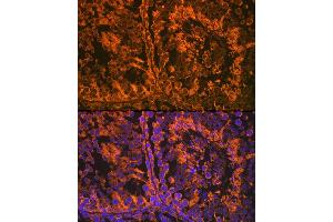 Immunofluorescence analysis of mouse testis using SRD5 Rabbit mAb (ABIN7270595) at dilution of 1:100 (40x lens). (SRD5A2 antibody)