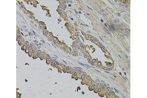 Immunohistochemistry of paraffin-embedded Human prostate using FMR1NB Polyclonal Antibody at dilution of 1:100 (40x lens). (FMR1NB antibody)