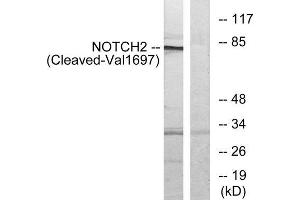 Western blot analysis of extracts from Jurkat cells, treated with etoposide (25uM, 24hours), using NOTCH2 (Cleaved-Val1697) antibody.