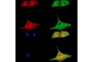 ABIN7096909 and ABIN7100975 staining  cells by IF/ICC. (Clavesin 1 antibody)